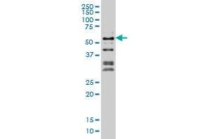 NFIC monoclonal antibody (M03), clone 1D6 Western Blot analysis of NFIC expression in Hela S3 NE . (NFIC anticorps  (AA 314-423))