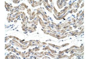 SFRS10 antibody was used for immunohistochemistry at a concentration of 4-8 ug/ml to stain Skeletal muscle cells (arrows) in Human Muscle. (TRA2B anticorps)