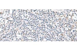 Immunohistochemistry of paraffin-embedded Human tonsil tissue using PAM16 Polyclonal Antibody at dilution of 1:60(x200) (MAGMAS anticorps)