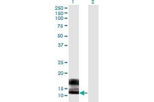 Western Blot analysis of SPRR2F expression in transfected 293T cell line by SPRR2F monoclonal antibody (M03), clone 5A9.