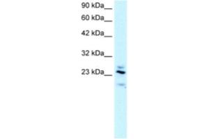Western Blotting (WB) image for anti-Regulator of G-Protein Signaling 20 (RGS20) antibody (ABIN2460854) (RGS20 anticorps)