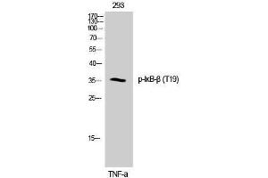 Western Blotting (WB) image for anti-NF-kappa-B inhibitor beta (NFKBIB) (pThr19) antibody (ABIN3180433) (NFKBIB anticorps  (pThr19))