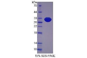 SDS-PAGE analysis of Mouse SCEL Protein. (SCEL Protéine)