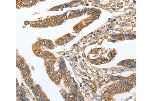 Immunohistochemistry (IHC) image for anti-Cytoskeleton Associated Protein 2 (CKAP2) antibody (ABIN2423165)