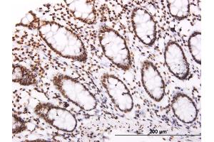 Immunoperoxidase of monoclonal antibody to SOCS3 on formalin-fixed paraffin-embedded human colon.