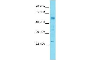 Host:  Rabbit  Target Name:  Hoxa3  Sample Type:  Rat Lung lysates  Antibody Dilution:  1. (HOXA3 anticorps  (Middle Region))