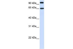WB Suggested Anti-NTRK3 Antibody Titration:  0. (NTRK3 anticorps  (C-Term))