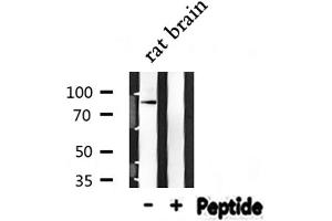 Western blot analysis of NEDD9 expression in Rat brain lysate (NEDD9 anticorps  (Internal Region))