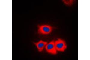 Immunofluorescent analysis of SSBP1 staining in HeLa cells. (SSBP1 anticorps  (C-Term))