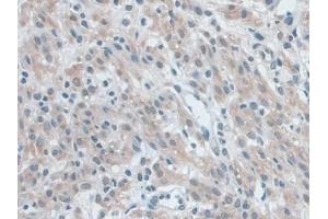 Detection of NLRP3 in Mouse Uterus Tissue using Polyclonal Antibody to NLR Family, Pyrin Domain Containing Protein 3 (NLRP3)