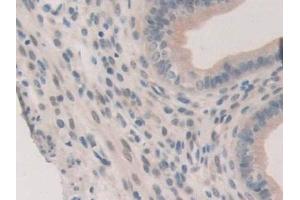 Detection of ERa in Mouse Uterus Tissue using Polyclonal Antibody to Estrogen Receptor Alpha (ERa) (Estrogen Receptor alpha anticorps  (AA 233-483))
