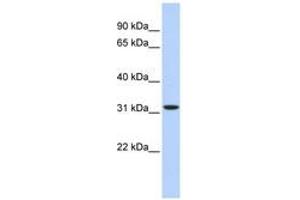 Image no. 1 for anti-3-hydroxyisobutyrate Dehydrogenase (HIBADH) (AA 252-301) antibody (ABIN6741224) (HIBADH anticorps  (AA 252-301))