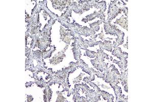 IHC analysis of MPI using anti-MPI antibody (ABIN4886672). (MPI anticorps  (AA 2-99))