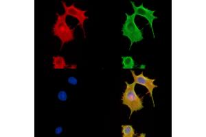 ABIN6260322 and ABIN6279883 staining HepG2 cells by IF/ICC.