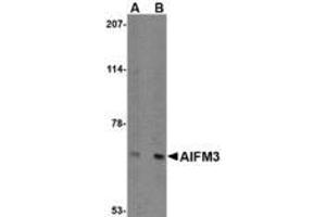 Image no. 1 for anti-Apoptosis-Inducing Factor, Mitochondrion-Associated, 3 (AIFM3) (N-Term) antibody (ABIN1494348) (AIFM3 anticorps  (N-Term))