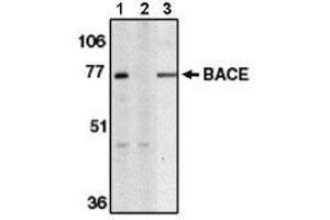 Image no. 1 for anti-Beta-secretase 1 (BACE1) (AA 485-501) antibody (ABIN264995) (BACE1 anticorps  (AA 485-501))
