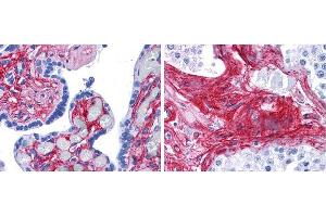 Anti collagen VI antibody (1:400 45 min RT) showed strong staining in FFPE sections of human placenta (Left) with red staining of stromal and extracellular spaces, and in testis (Right) with staining of extracellular spaces between seminiferous tubules).