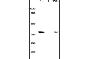 Lane 1: rat heart lysates Lane 2: rat embryo lysates probed with Anti Coxsackie Adenovirus Receptor Polyclonal Antibody, Unconjugated (ABIN739575) at 1:200 in 4C. (GM1123 anticorps  (AA 21-120))