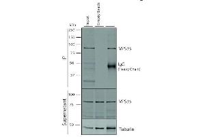 Immunoprecipitation analysis using Mouse Anti-VPS35 Monoclonal Antibody, Clone 5A9 (ABIN6932936).
