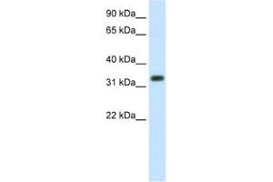 Western Blotting (WB) image for anti-E3 Ubiquitin-Protein Ligase SIAH1 (SIAH1) antibody (ABIN2461673) (SIAH1 anticorps)