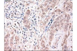 Immunohistochemical staining of paraffin-embedded kidney using anti-Trim33 (ABIN2452534) mouse monoclonal antibody. (TRIM33 anticorps  (AA 887-1046))