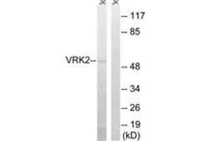 Western Blotting (WB) image for anti-Vaccinia Related Kinase 2 (VRK2) (AA 171-220) antibody (ABIN2890623) (VRK2 anticorps  (AA 171-220))