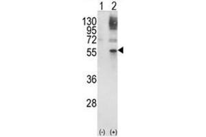 Western blot analysis of GATA2 (arrow) using rabbit polyclonal GATA2 Antibody (Center) . (GATA2 anticorps  (Middle Region))
