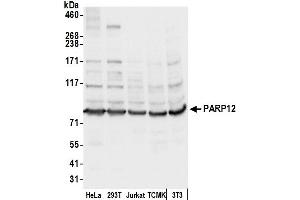 anti-Poly (ADP-Ribose) Polymerase Family, Member 12 (PARP12) (AA 300-350) antibody