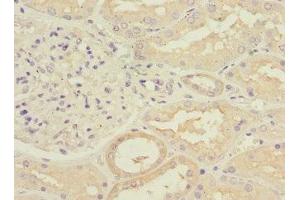 Immunohistochemistry of paraffin-embedded human kidney tissue using ABIN7175891 at dilution of 1:100 (RPGRIP1 anticorps  (AA 400-580))