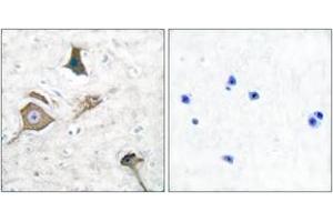Immunohistochemistry analysis of paraffin-embedded human brain tissue, using MMP-16 Antibody. (MMP16 anticorps  (AA 551-600))