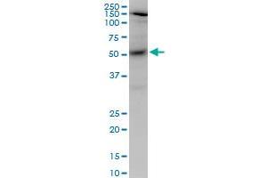 AKT1 monoclonal antibody (M03), clone 2E11.
