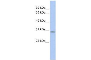 WB Suggested Anti-VSTM2A Antibody Titration: 0. (VSTM2A anticorps  (Middle Region))