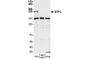 Western Blotting (WB) image for anti-Envoplakin (EVPL) (AA 1275-1325) antibody (ABIN7449223)