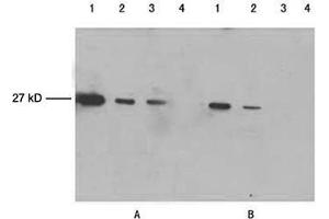 Lane 1-3: 100 ng, 25 ng, 10 ng GFP fusion proteinLane 4: Negative controlPrimary antibody: A. (GFP anticorps)