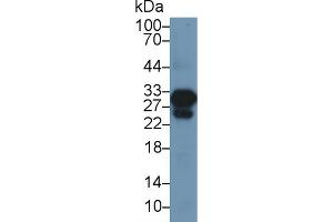 Detection of cTnI in Rat Heart lysate using Polyclonal Antibody to Cardiac Troponin I (cTnI)