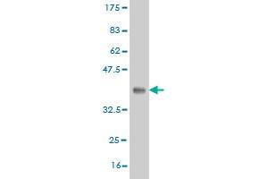 Western Blot detection against Immunogen (37.
