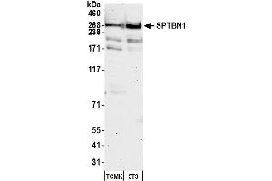 Western Blotting (WB) image for anti-Spectrin Beta, Non-Erythrocytic 1 (SPTBN1) (AA 2100-2150) antibody (ABIN7454694) (SPTBN1 anticorps  (AA 2100-2150))