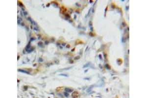 Used in DAB staining on fromalin fixed paraffin-embedded Pancreas tissue (CST6 anticorps  (AA 29-149))