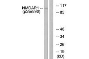 Western blot analysis of extracts from K562 cells treated with PMA 125ng/ml 30', using NMDAR1 (Phospho-Ser896) Antibody. (GRIN1/NMDAR1 anticorps  (pSer897))