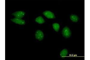 Immunofluorescence of purified MaxPab antibody to NSMCE2 on HeLa cell.