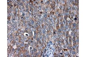 Immunohistochemical staining of paraffin-embedded liver tissue using anti-CD36 mouse monoclonal antibody. (CD36 anticorps)