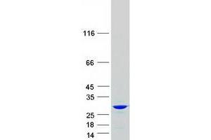 Validation with Western Blot