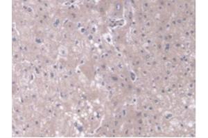 IHC-P analysis of Human Liver Tissue, with DAB staining. (TOM70 anticorps  (AA 333-608))