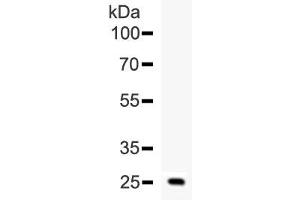 Western blot testing of human ESM1 recombinant protein (1ng/lane) with ESM1 antibody at 0. (ESM1 anticorps  (AA 20-184))