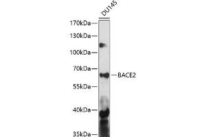 Western blot analysis of extracts of DU145 cells, using B antibody (ABIN7265880) at 1:1000 dilution.