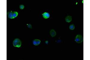 Immunofluorescence staining of MCF-7 cells with ABIN7157388 at 1:133, counter-stained with DAPI.