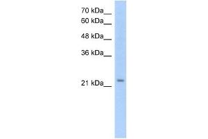 EMP2 antibody used at 1. (EMP2 anticorps  (Middle Region))