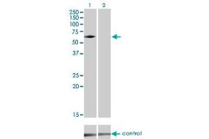 Western blot analysis of IRAK3 over-expressed 293 cell line, cotransfected with IRAK3 Validated Chimera RNAi (Lane 2) or non-transfected control (Lane 1). (IRAK3 anticorps  (AA 497-596))