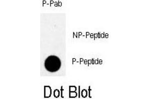 Dot Blot (DB) image for anti-RAD9 Homolog A (S. Pombe) (RAD9A) (pSer328) antibody (ABIN3001777) (RAD9A anticorps  (pSer328))