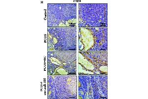 MiR-185 inhibited the angiogenic effect in the ovaries of PCOS rats.